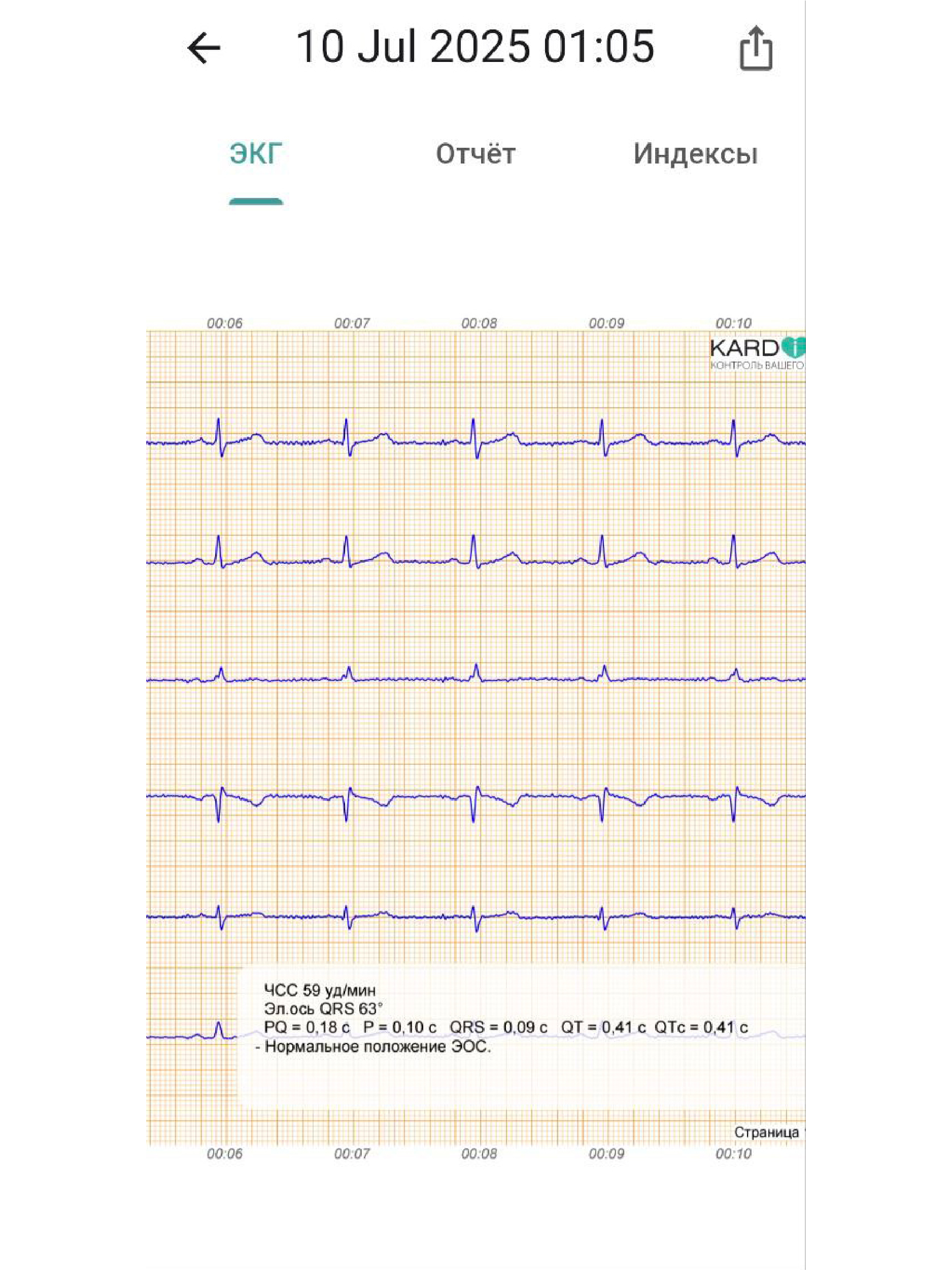 картинка КардиРу-BLE Портативный кардиограф для самостоятельной регистрации ЭКГ 