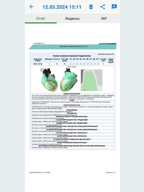 картинка КардиРу-BLE Портативный кардиограф для самостоятельной регистрации ЭКГ 
