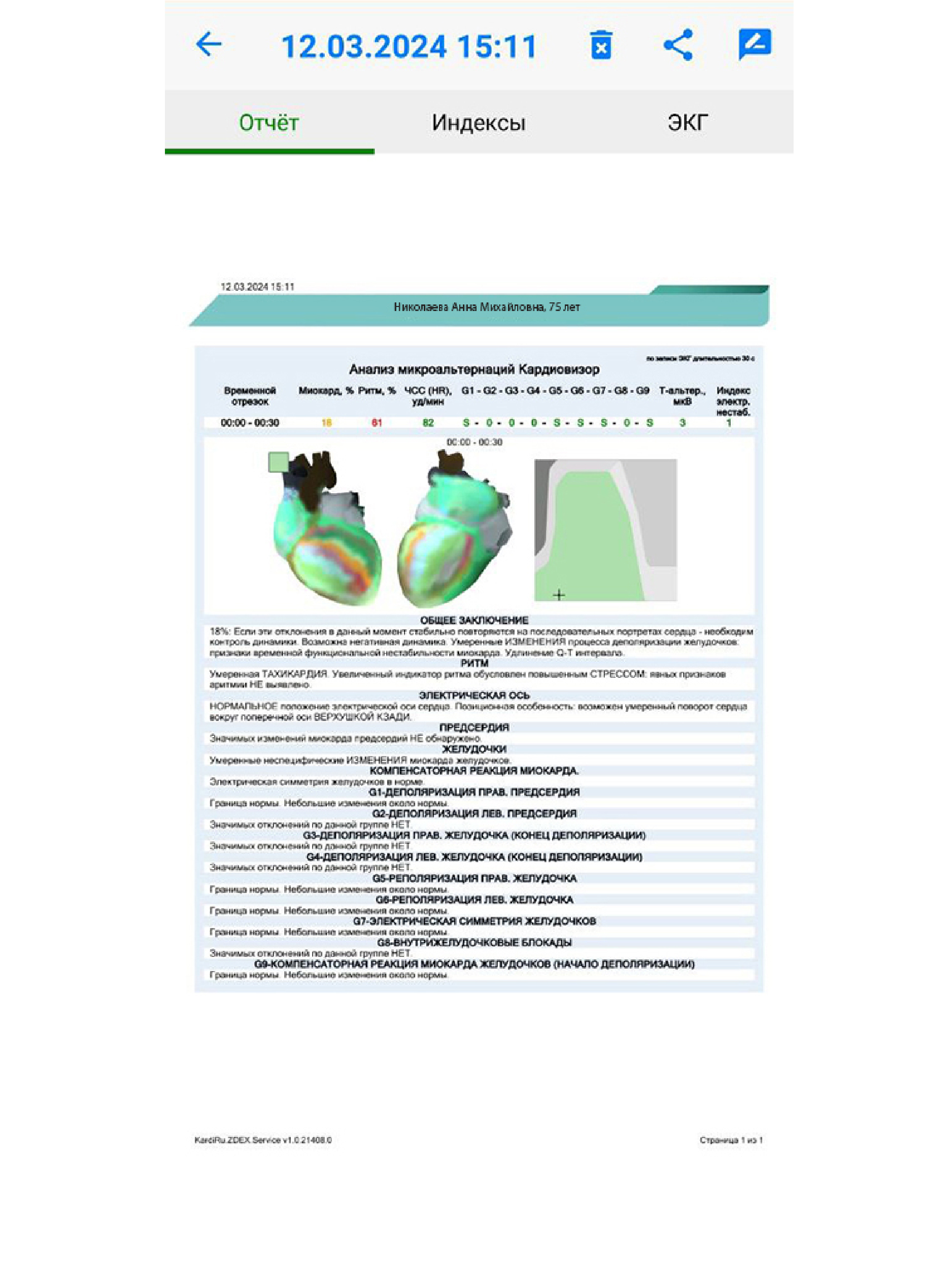 картинка КардиРу-BLE Портативный кардиограф для самостоятельной регистрации ЭКГ 