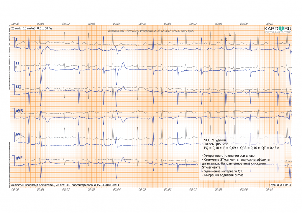 картинка КардиРу-BLE Портативный кардиограф для самостоятельной регистрации ЭКГ 