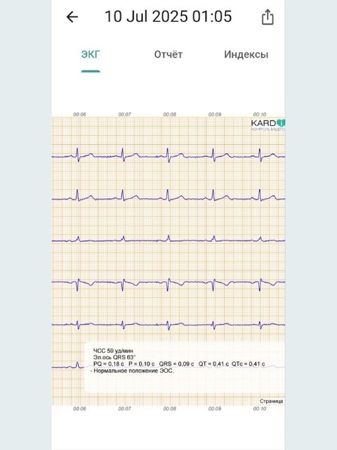 картинка КардиРу-BLE Портативный кардиограф для самостоятельной регистрации ЭКГ 